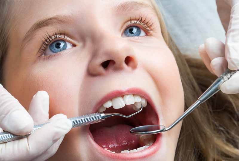 Nhổ răng sữa tại nha khoa đảm bảo an toàn sức khỏe răng miệng của trẻ