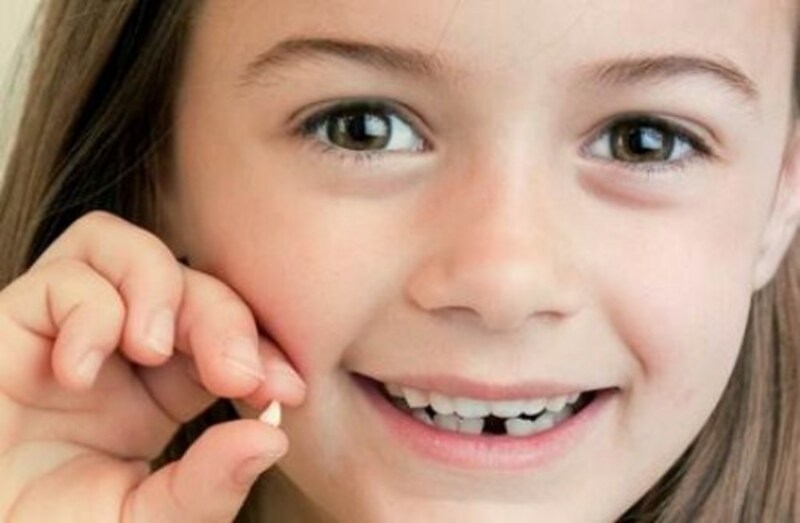 việc thay răng sữa đúng thời điểm là rất quan trọng, quyết định đến hàm răng vĩnh viễn sau này