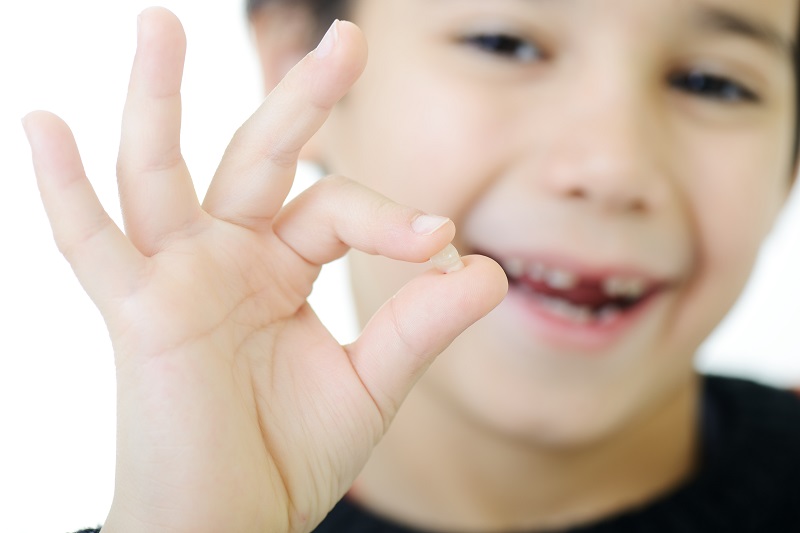 Cần lưu ý cách khắc phục tình trạng nhổ răng sữa sót chân răng ở trẻ