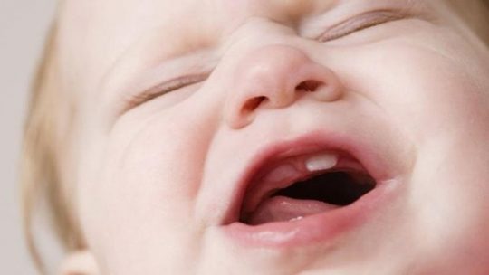 Có nhiều nguyên nhân khiến trẻ chậm mọc răng
