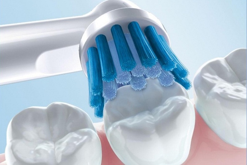 Việc vệ sinh răng miệng kém làm gia tăng nguy cơ viêm nướu răng sứ