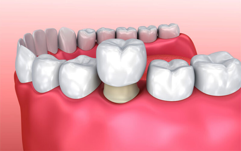 Cần phải bảo vệ răng miệng khi bị viễm nhiễm 