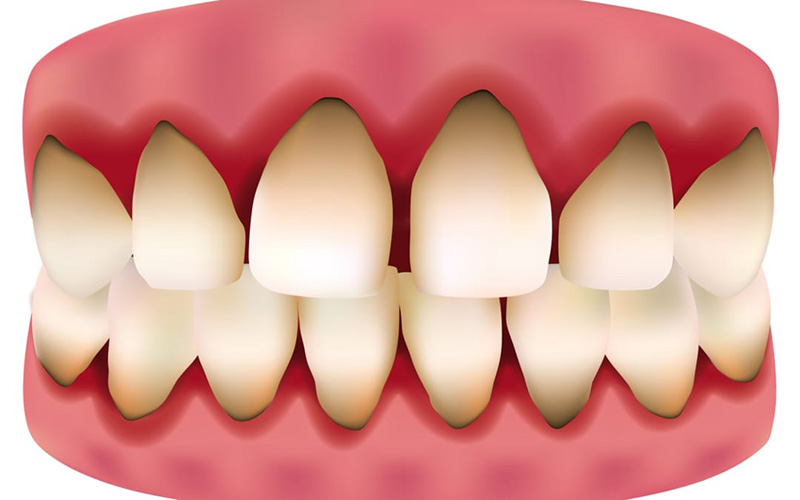 Các răng được hình thành trong xương hàm trước khi sinh ra