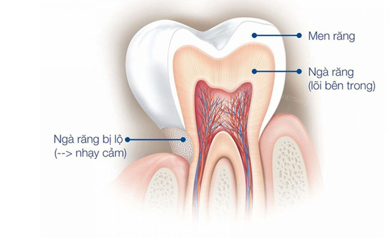 Ngà răng là một lớp cứng dày và nằm dưới lớp men răng