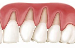 Răng là gì? Cấu tạo, chức năng và quy trình mọc răng ra sao?