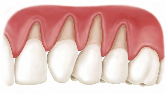 Răng là gì? Cấu tạo, chức năng và quy trình mọc răng ra sao?