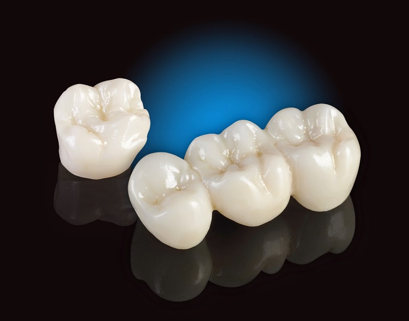 Hiện nay có 2 loại răng sứ Cercon phổ biến nhất là Cercon Zirconia và Cercon HT
