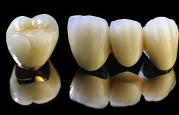 Bọc răng sứ có bền không? Làm gì để duy trì độ bền của răng sứ