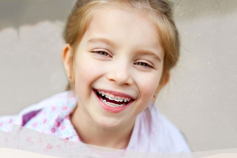Trẻ bao nhiêu tuổi thì niềng răng được là thắc mắc của nhiều bậc phụ huynh