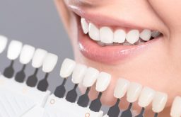 Trồng răng sứ vĩnh viễn giúp đảm bảo sức khỏe răng miệng và tính thẩm mỹ