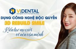 Công nghệ thiết kế nụ cười Rebuild Smile tại ViDental