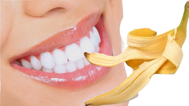 Vỏ chuối có tác dụng làm trắng răng nhờ chứa hàm lượng lớn chất Potassium