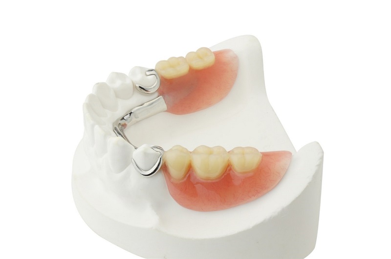 Người cao tuổi sau khi nhổ răng nên dùng răng giả tháo lắp để đảm bảo an toàn
