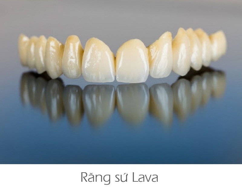 Răng sứ Lava là dòng sản phẩm được sản xuất bởi tập đoan 3M (Mỹ)