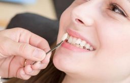 Trồng răng nanh bao nhiêu tiền được nhiều người thắc mắc đặt ra khi không may bị mất răng, răng kém thẩm mỹ