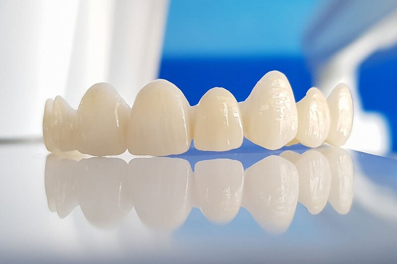 Có tẩy trắng răng sứ được không là thắc mắc chung của những người có răng sứ bị ố vàng, xỉn màu