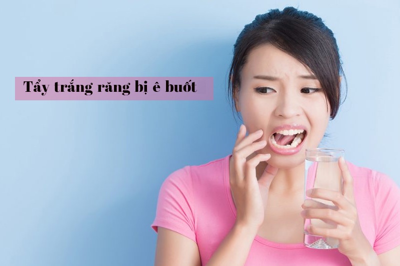 Tẩy trắng răng bị buốt là hiện tượng bình thường mà khá nhiều người gặp phải