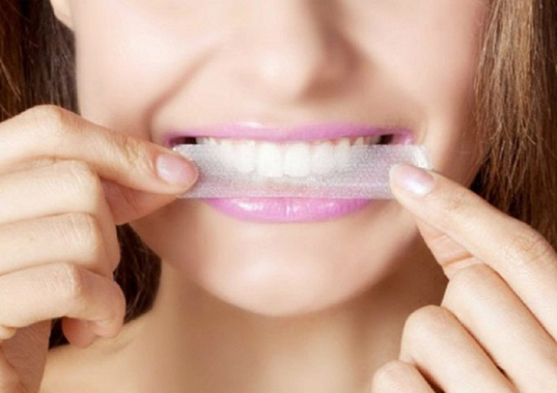 Miếng dán trắng răng khá nhỏ gọn, dễ dùng và chi phí hợp lý