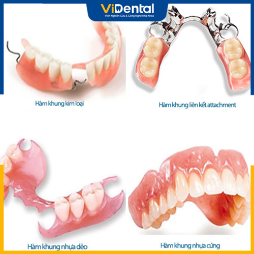 Mỗi loại hàm răng giả tháo lắp có mức giá khác nhau