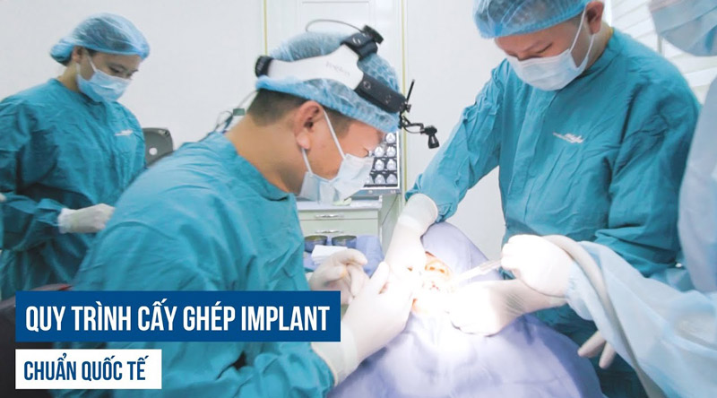 Các bác sĩ thực hiện cấy răng Implant cần có tay nghề cao, giàu kinh nghiệm