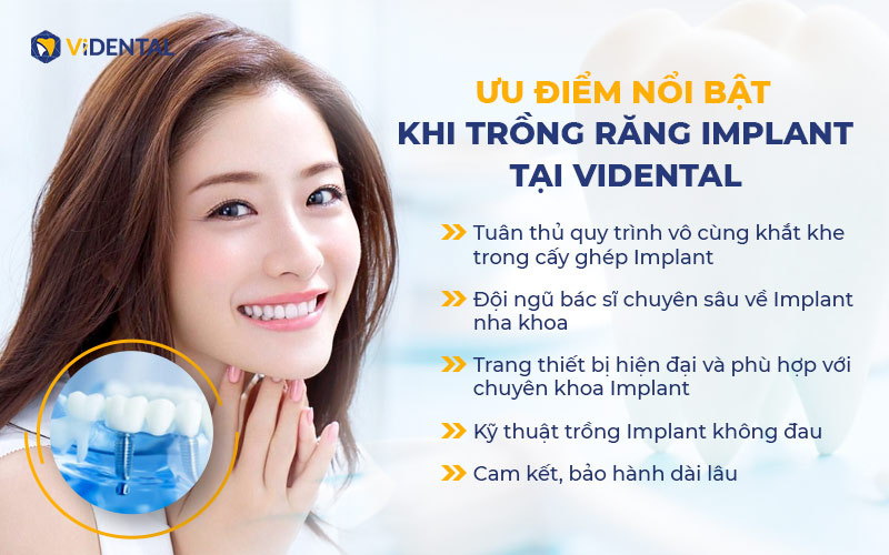 Những ưu điểm khi lựa chọn trồng răng Implant tại ViDental