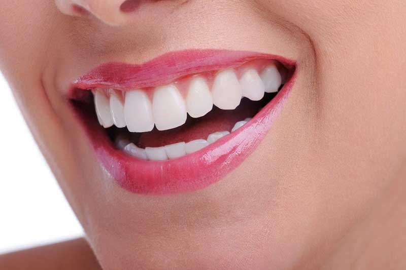 Trồng răng Implant toàn hàm giúp mang tới nụ cười tự tin cho người bệnh