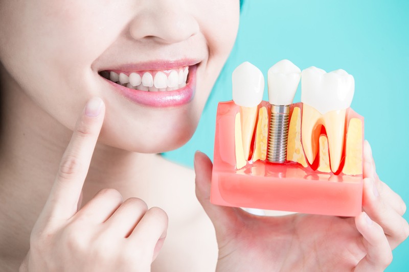 Trồng răng implant là giải pháp khắc phục được gần như tất cả các trường hợp bị mất răng lâu năm