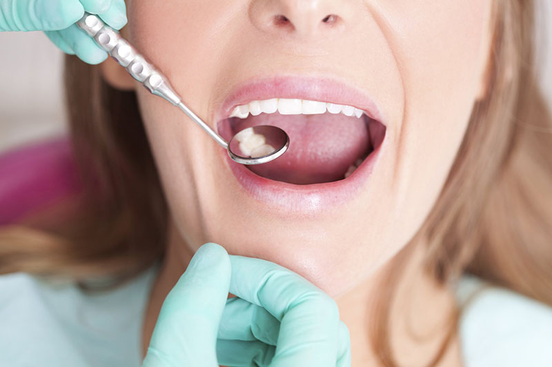 Các vấn đề răng miệng như sâu răng, viêm lợi, viêm nha chu,.... có thể gây hôi miệng