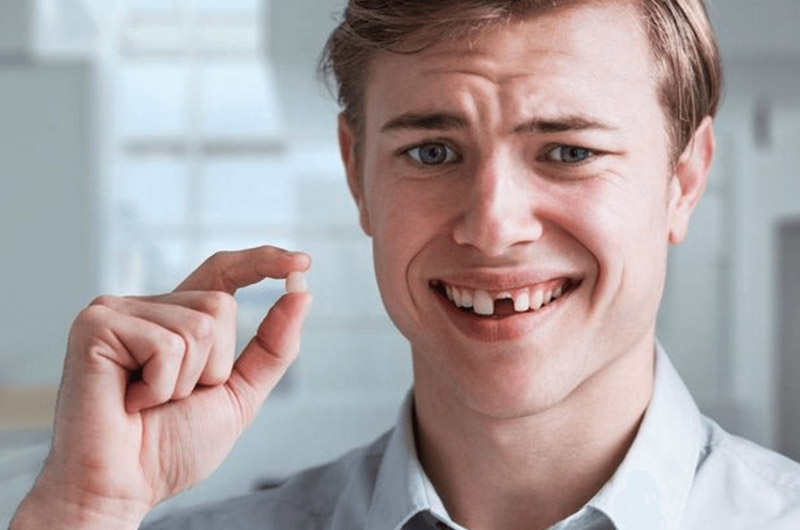 Trồng răng khi còn chân răng được nhiều khách hàng quan tâm hiện nay