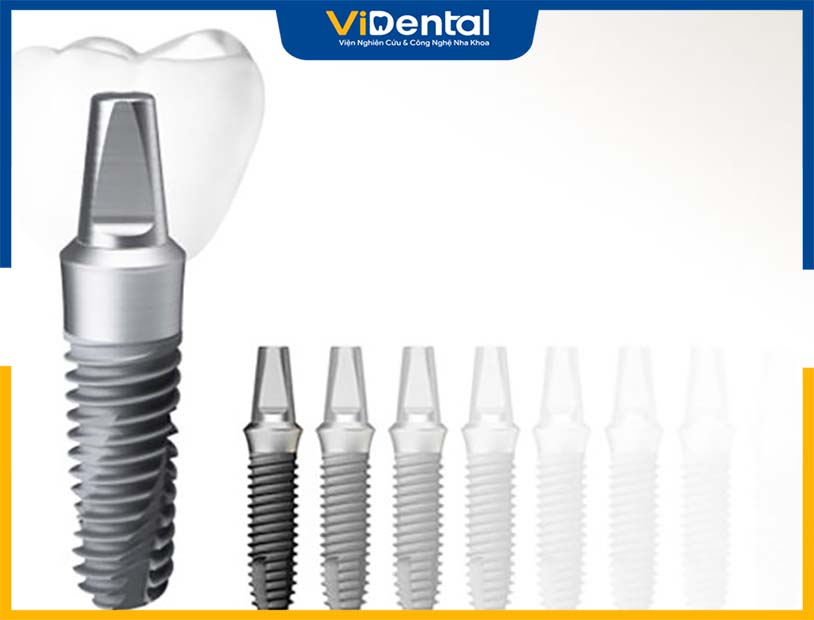 Trụ Implant Hiossen Và Những Điều Cần Biết