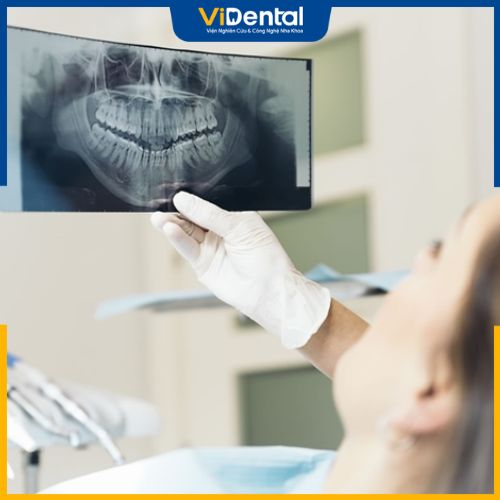 ViDental Implant - Địa chỉ trồng răng uy tín hàng đầu hiện nay