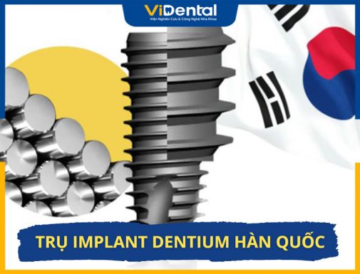 Trụ Implant Dentium Hàn Quốc Có Tốt Không? Giá Bao Nhiêu?