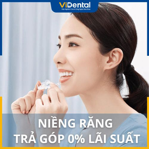 Chỉnh nha 0% lãi suất tại ViDental