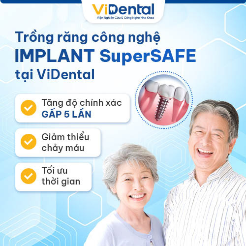 Công nghệ IMPLANT SuperSAFE mang đến hiệu quả điều trị cao nhất