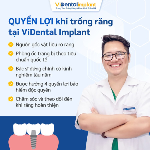 ViDental Implant - Địa chỉ phục hình răng AN TOÀN - HIỆU QUẢ