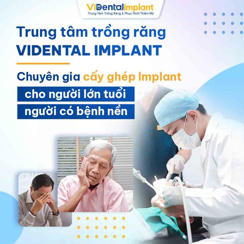 ViDental Implant là địa chỉ tin cậy cung cấp dịch vụ cấy ghép Implant