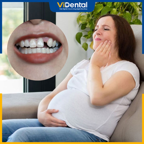 Mẹ bầu có thể mất răng vì nhiều nguyên nhân