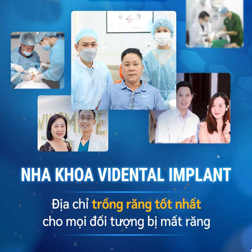 Dịch vụ cấy ghép Implant ViDental Implant là lựa chọn tốt nhất