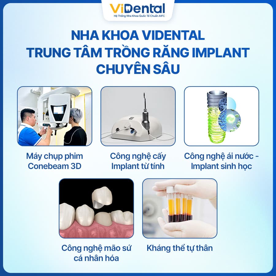 Công nghệ trồng răng hiện đại