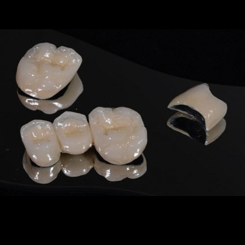 Răng sứ Titan có cấu tạo 3 lớp