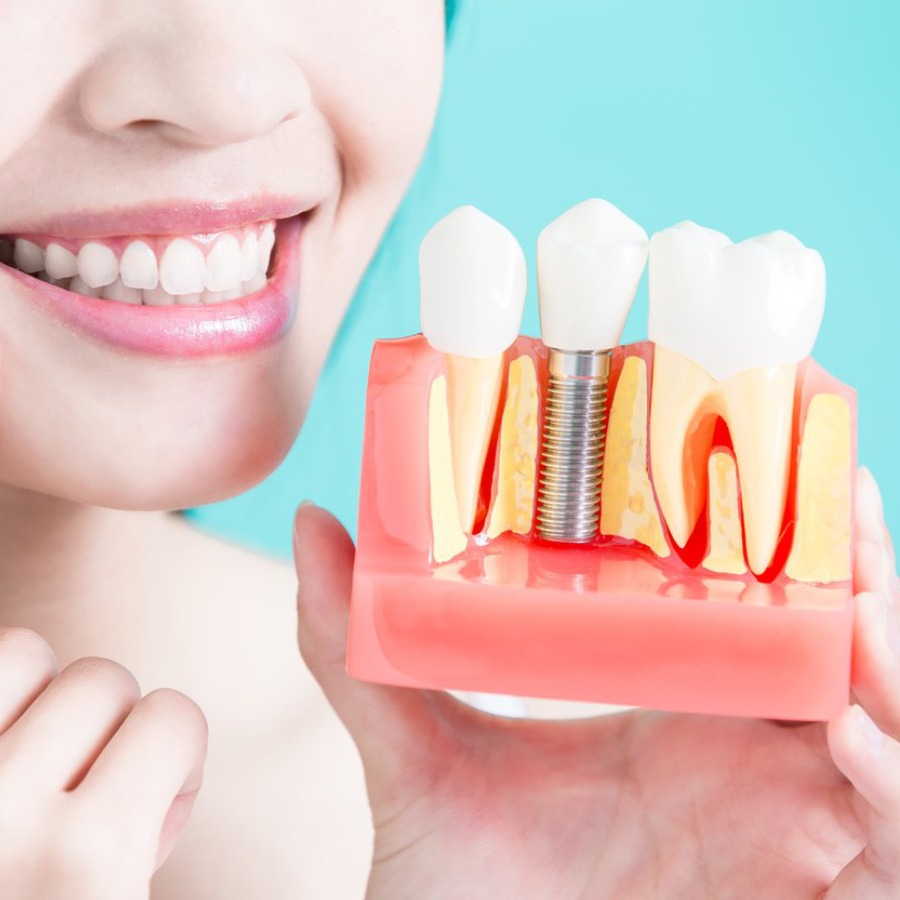 Hình ảnh khách hàng sau khi sử dụng dịch vụ tại ViDental Implant