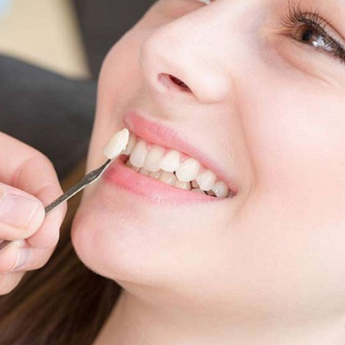 Trồng răng khểnh có thể gây đau nhức và khó chịu