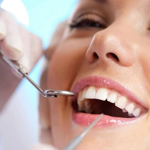 Bọc răng sứ mất từ 3 - 5 ngày để hoàn thành