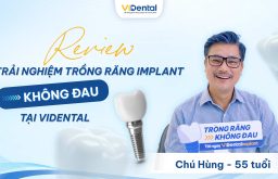 [Review] Trải nghiệm quá trình trồng răng không đau bằng công nghệ từ tính