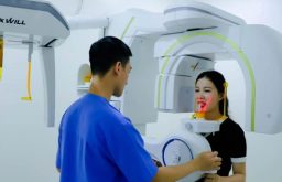 Lý Do Nên Chụp Phim Cone Beam CT Trong Trồng Răng Implant?