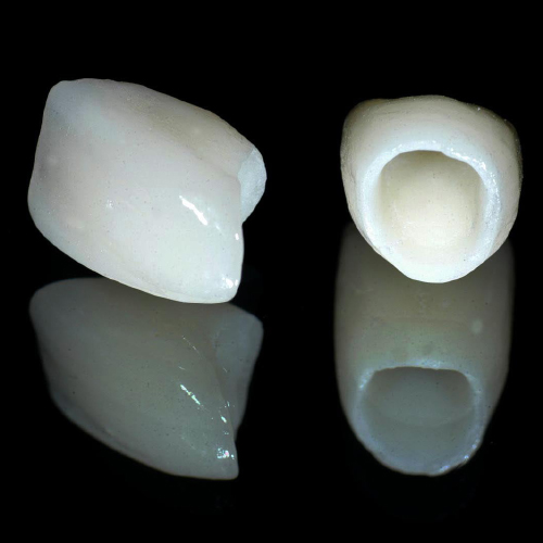 Mão răng sứ được thiết kế với hình dáng giống răng thật.