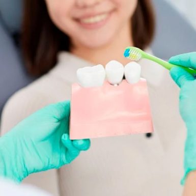 Hướng Dẫn Vệ Sinh Răng Implant Đúng Cách, Tuổi Thọ Lâu Dài
