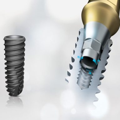 Trụ Implant Đức ICX: Xuất Xứ, Cấu Tạo Và Giá Thành