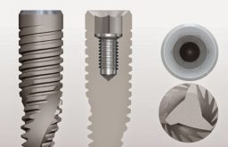 Trụ Implant Mis C1 Đức: Cấu Tạo, Ưu Nhược Điểm Và Chi Phí