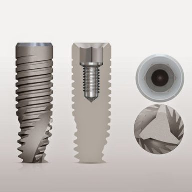 Trụ Implant Mis C1 Đức: Cấu Tạo, Ưu Nhược Điểm Và Chi Phí